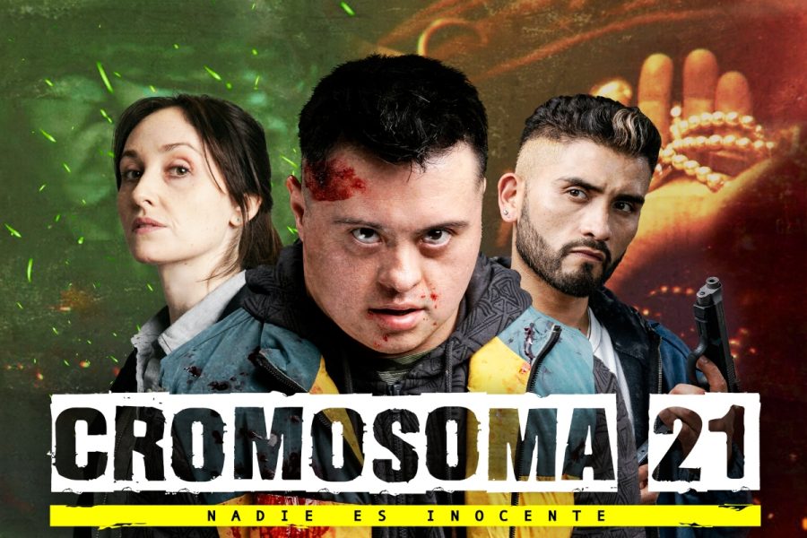 21 хромосома